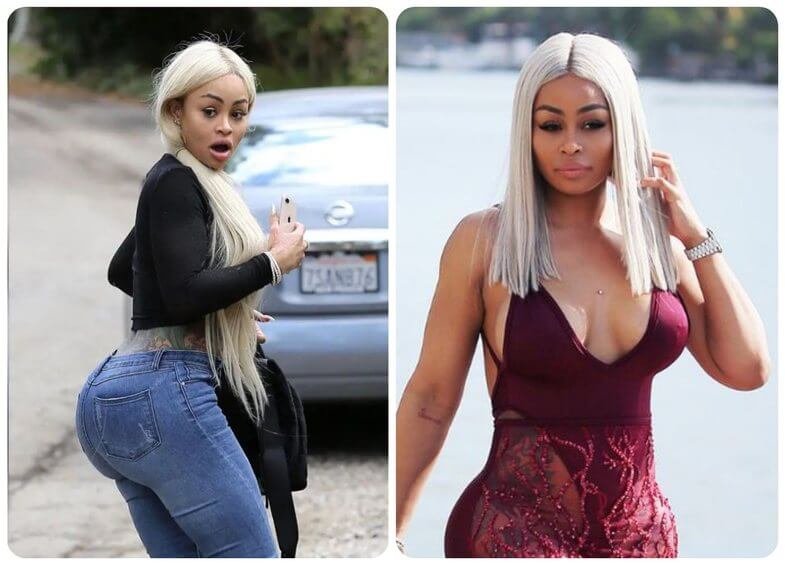 Blac Chyna: From Model and Entrepreneur to a New Chapter in the Spotlight Blac Chyna: From Model and Entrepreneur to a New Chapter in the Spotlight